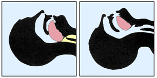 First Aid for Breathing Difficulties First Aid for Breathing Difficulties